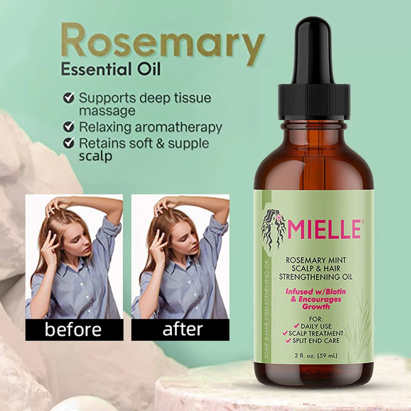 Rosemary Hair Growth Essential Oil - BeautyHacks